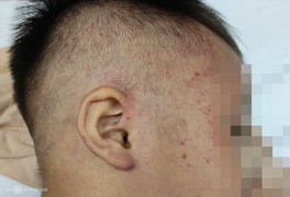 Sức khoẻ bé hơn 3 tuổi nghi bị bạo hành, nhốt trong tủ cấp đông hiện thế nào?