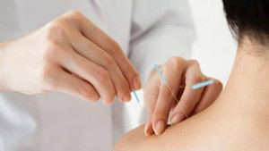 Các lợi ích sức khoẻ tiềm năng khi châm cứu