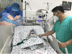 Bé 3 tháng tuổi chảy máu tiêu hoá, bác sĩ phát hiện lúc nhúc giun ở ruột