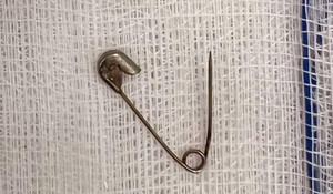 Bé 6 tháng tuổi suýt bị kim băng đâm thủng dạ dày
