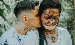 Cái kết đẹp của cô gái ‘dị ứng với ánh mặt trời’ và chàng trai quen qua mạng