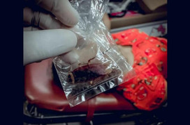 Người phụ nữ phải nhập viện cấp cứu vì bị gián cắn lúc đang ngủ