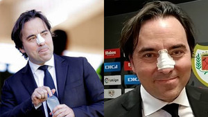 Đàm phán bất thành, đại diện cầu thủ húc gãy mũi chủ tịch đội bóng