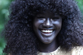 Cô gái từng bị bắt nạt vì làn da đen độc đáo bất ngờ thành danh nhờ đặc điểm này