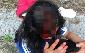 Không mua nước giúp bạn, nữ sinh lớp 8 ở Huế bị đánh chảy máu đầu