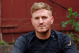 Người đàn ông 37 tuổi phát hiện bị u não sau 12 năm xuất hiện triệu chứng