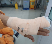 Đi nhắc nợ, nhân viên điện lực ở TP.HCM bị khách hàng đánh nhập viện