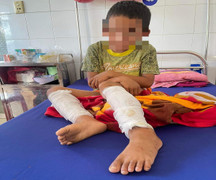  Cháu bé lớp 3 bị cha đốt bằng xăng và rơm ở Quảng Bình