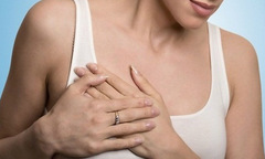 Áo ngực có phải nguyên nhân gây ung thư vú?