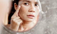 4 thói quen làm tăng nguy cơ mắc ung thư