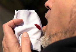 Ho ra máu là biểu hiện của bệnh gì?