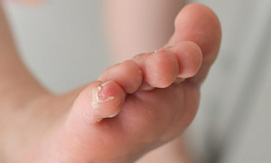 Con trai 18 tháng tuổi mắc giang mai, ngã ngửa khi cả nhà ba người bị bệnh