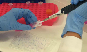 'Đại dịch ung thư', nguy cơ không ngờ từ COVID-19