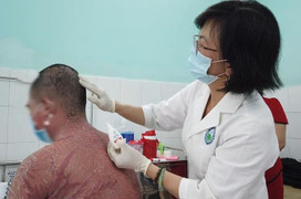 Nhập viện vì dùng thuốc chữa vảy nến trên mạng