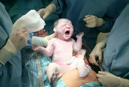 Không cho bác sĩ nam đỡ đẻ, mẹ chồng suýt hại cả con dâu và cháu