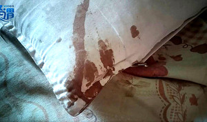 Thức giấc vì đau, người đàn ông sợ hãi thấy tai mình bị chuột cắn nham nhở