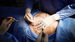 Người phụ nữ mất 6 lít máu sau hút mỡ tại Bệnh viện chuyên khoa Thẩm mỹ Đông Á