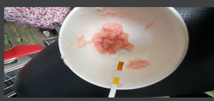 Cần Thơ: Test nhanh phát hiện cơ sở kinh doanh chả cá dương tính với hàn the 