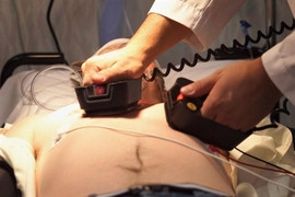 Sốc điện 20 lần để cứu người từ cõi chết