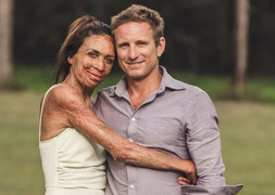 Bị biến dạng vì bỏng, cô gái vẫn được ngưỡng mộ bởi chuyện tình đẹp như mơ