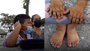 Cậu học sinh Thái Lan có 12 ngón tay, 12 ngón chân