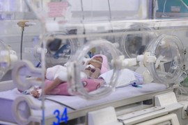 Cha mẹ ngại khám tầm soát, trẻ sinh non dễ bị bong võng mạc