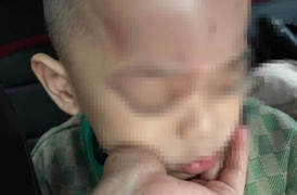 Xác minh thông tin trẻ bị bạo hành ở trường mầm non tại Đà Nẵng