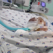 TP.HCM: Bé 6 tháng tuổi xuất huyết não nghi bị bạo hành