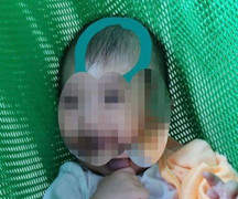 Bé 6 tháng tuổi bị đánh dập não: Nạn nhân thương tích 99%