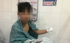 Cảnh báo gia tăng tai nạn do sử dụng pháo nổ dịp Tết 