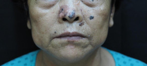 7 nguyên tắc quen thuộc giúp phòng ung thư hiệu quả