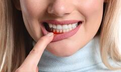 Điều gì xảy ra nếu bạn lười đánh răng?