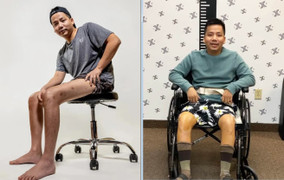 Chi tiền tỷ kéo dài chân, vẻ ngoài YouTuber Khoa Pug hiện tại thế nào?