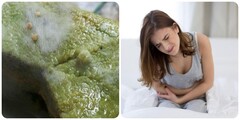 Bánh chưng sau Tết có dấu hiệu này bỏ ngay kẻo ngộ độc