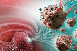 Ung thư là gì và nguyên nhân gây bệnh do đâu?