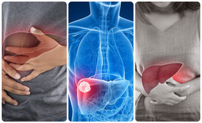 6 dấu hiệu ung thư gan giai đoạn cuối