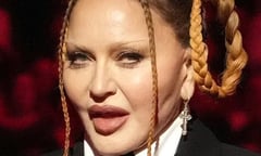 Nhan sắc nữ hoàng nhạc pop Madonna gây sốc, fan kêu gọi ngừng phẫu thuật thẩm mỹ