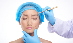 Chuyên gia chỉ công nghệ trẻ hóa da tốt nhất hiện nay