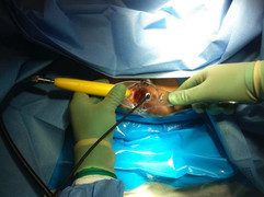 Chữa trĩ sai cách, nữ bệnh nhân phải truyền hơn 3 lít máu