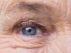 6 dấu hiệu cảnh báo đột quỵ sắp xảy ra trước một tuần