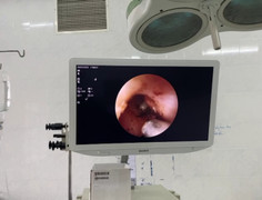 Ve chó chui vào tai bé trai 8 tuổi