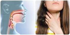 Dấu hiệu ung thư vòm họng giai đoạn đầu