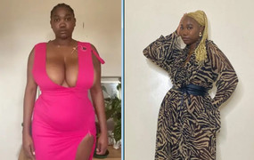 Vòng 1 lớn gây khó thở, cô gái chi 200 triệu đồng phẫu thuật thu nhỏ