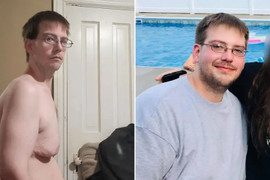 Nỗi khổ cô đơn của người đàn ông có vòng 1 lớn bất thường