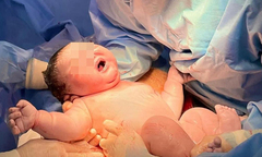 Bé sơ sinh nặng gần 6kg