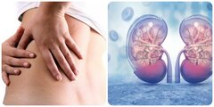 Dấu hiệu ung thư thận giai đoạn đầu