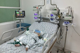 Phòng tránh tai nạn bỏng cho trẻ nhỏ thế nào?