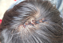 Truy bắt nhóm trộm gà đánh người trọng thương 