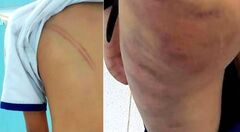 Khởi tố mẹ kế đánh dã man con chồng 