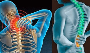 Dấu hiệu ung thư xương giai đoạn đầu